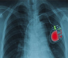 Investigación de Entelgy sobre vulnerabilidades del sector salud (Parte II)